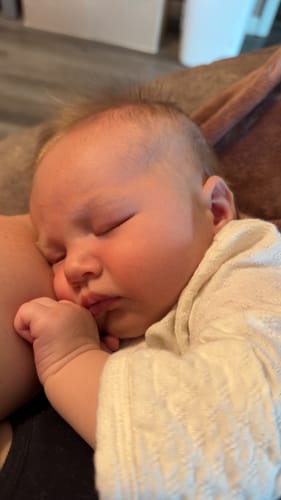 Customer photo review of Bye-Bye Cradle Cap