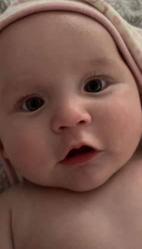 Customer photo review of Calm Balm