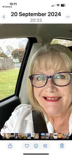 Customer photo review of Rosemary & Castor Oil for Hair Growth