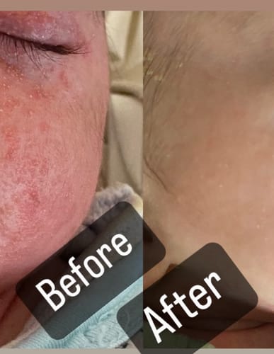 Customer photo review of Organic Barrier Balm 90g
