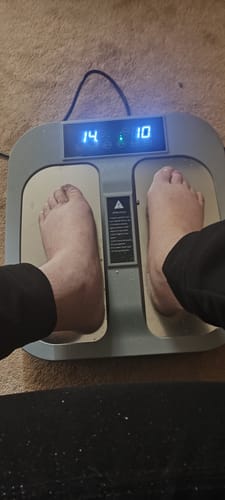 Customer photo review of Biomax Fusion Terahertz and Pulse Wellness System