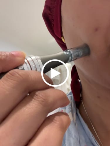 Customer video review of Nano Pin Cartridges for M8 (10 Pack)