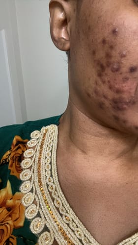 Customer photo review of Anti-Aging Moisturizing Body Lotion