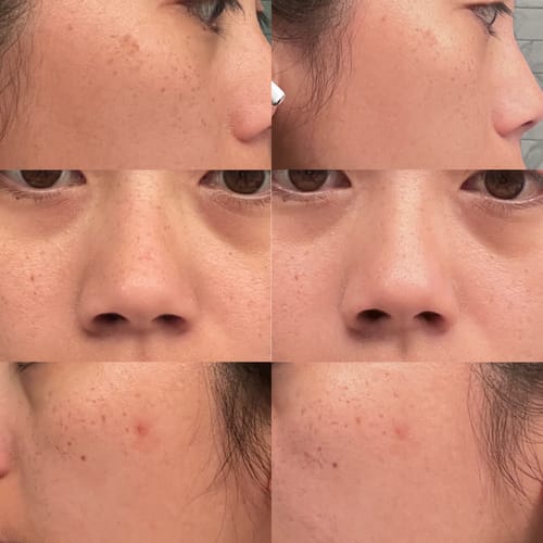 Customer photo review of The Complete System for Mature Women’s Skin