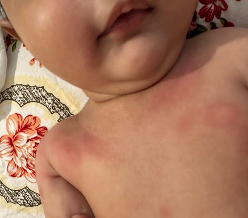 Customer photo review of Calm Balm