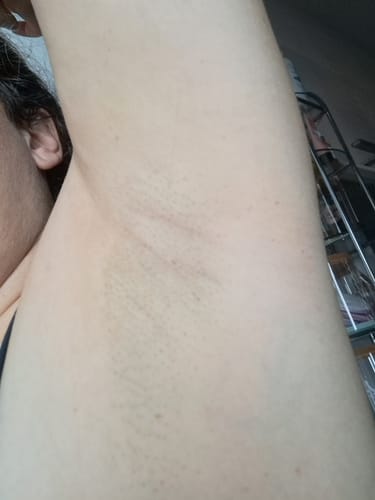 Customer photo review of DeoScrub