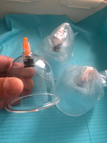 Customer photo review of Cupping Cups - Mixed Sizes from B1 to B6