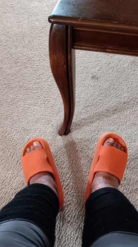 Customer photo review of The Compression System For The Feet & Calves (2 pack Each) | BLACK