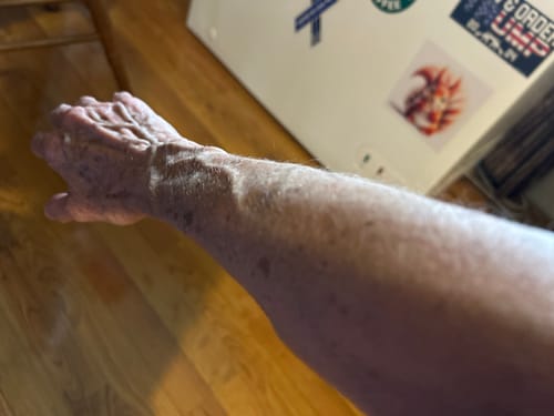 Customer photo review of Self Tanning 150 Capsules - ALMOST SOLD OUT