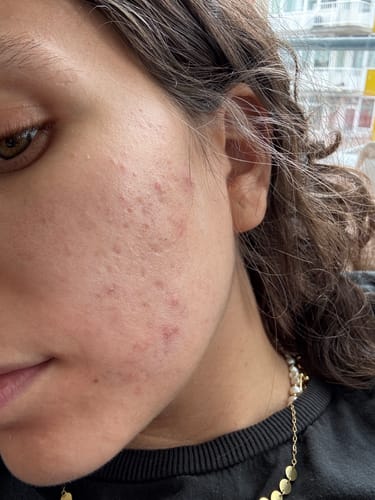 Customer photo review of Radiance Powder