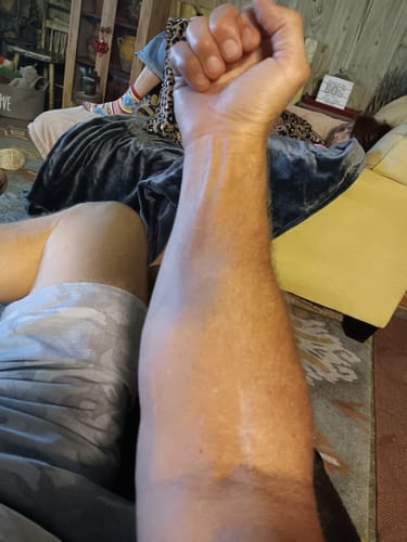 Customer photo review of Mama Bear Nerve Relief Roll-on