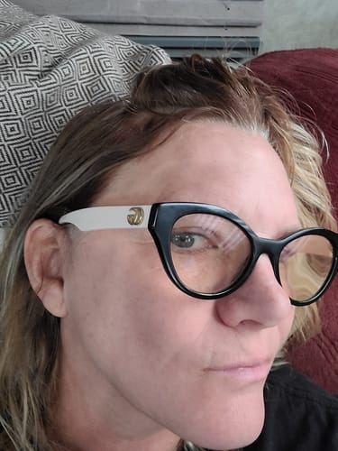 Customer photo review of Neptune Grass Fed Tallow & Honey Balm