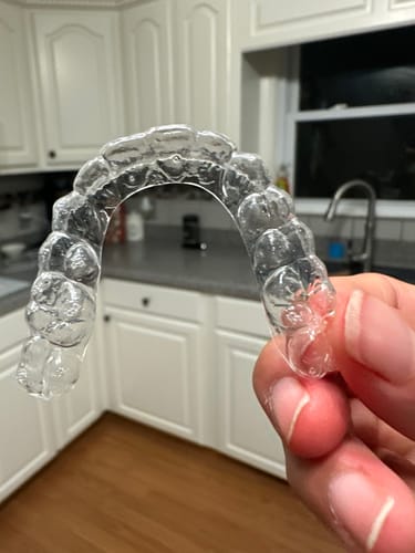 Customer photo review of Upper Teeth Retainer