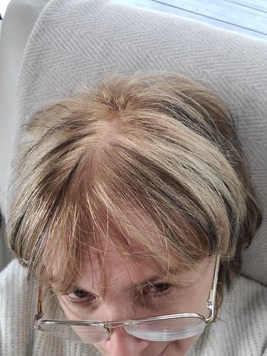 Customer photo review of Order Shipping Protection & Insurance