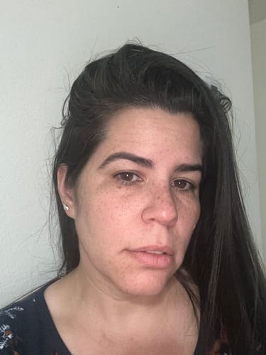 Customer photo review of 3 Month Supply - Deep Collagen Cream