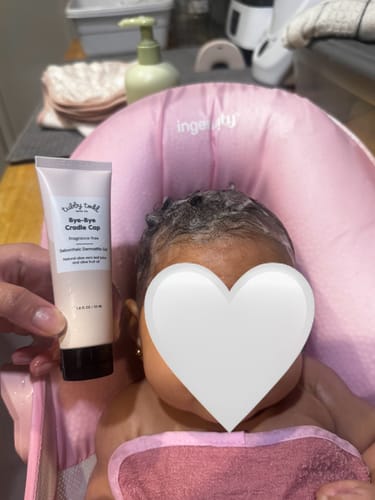 Customer photo review of Bye-Bye Cradle Cap Bundle
