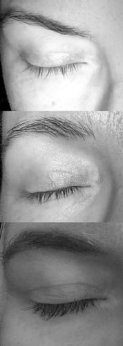 Customer photo review of LASH SERUM