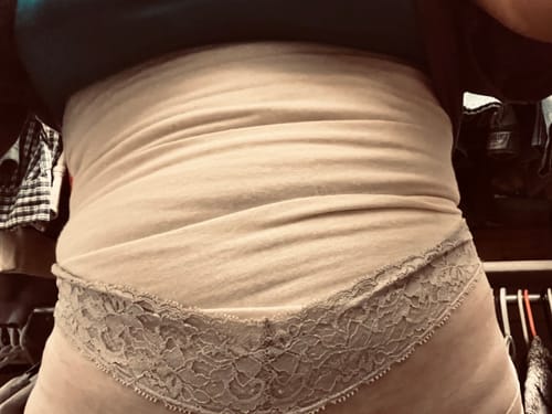 Customer photo review of SCULPT: Fat storage, cellulite, lymphatic stimulation with cotton wrap