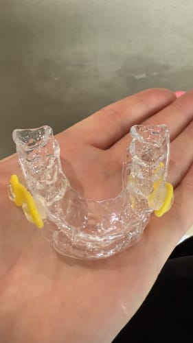 Customer photo review of Elastic Mandibular Advancement Appliance 5% Off Use Code EMA5 at checkout