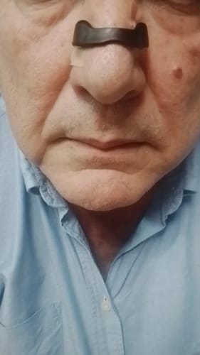 Customer photo review of EasyBreathe Starter Kit