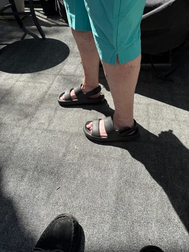 Customer photo review of Orthopedic Adjustable Sandals - Cloud Slides