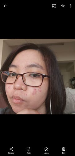 Customer photo review of Triple Action Serum