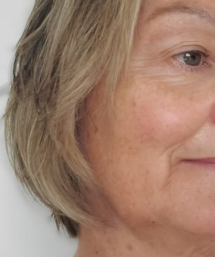 Customer photo review of Le Sérum (TH3+) - Lift et illumine