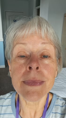 Customer photo review of 5-Step Clear Skin Kit