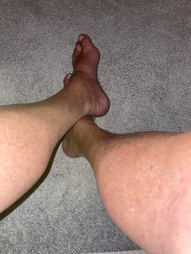 Customer photo review of HappyFlops