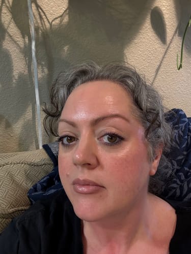 Customer photo review of JOVS | Blacken Pro DPL Photofacial Skincare Device