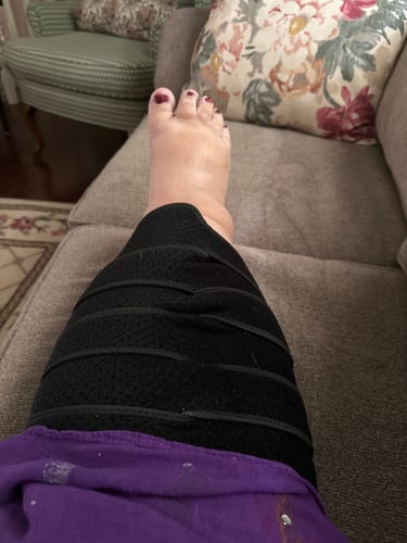 Customer photo review of Beltwell® Adjustable Calf Compression Wrap For Very Swollen Legs (1 wrap)