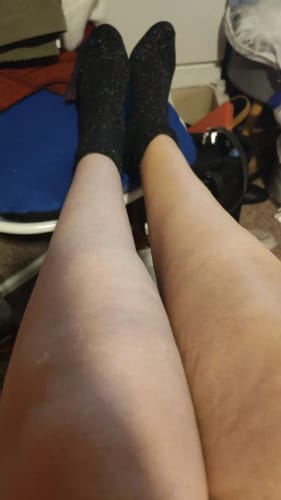 Customer photo review of Lumi Legs