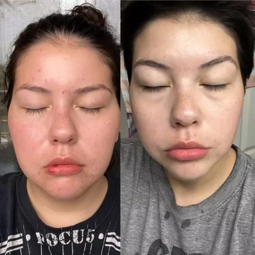 Customer photo review of The Korean Rice Peel Shot Duo