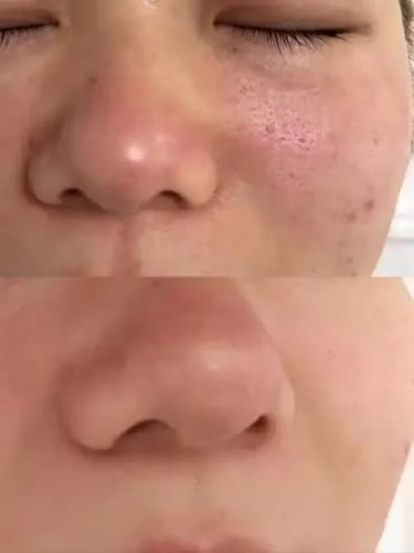Customer photo review of The Korean Rice Peel Shot Duo