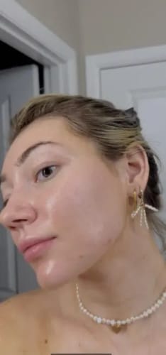 Customer photo review of The Korean Rice Peel Shot Duo