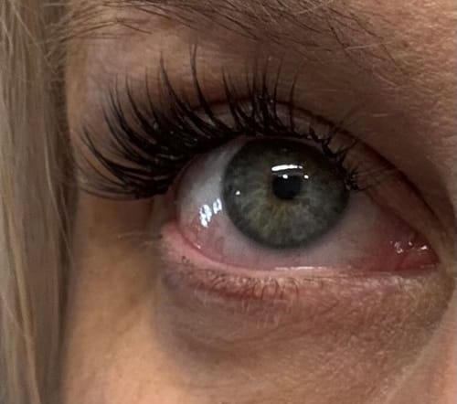 Customer photo review of PRETTY WOMEN STARTER KIT (5mm-15mm)