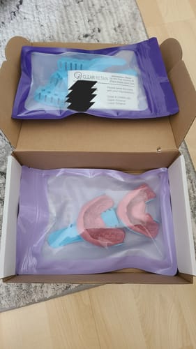 Customer photo review of Upper and Lower Retainers Set