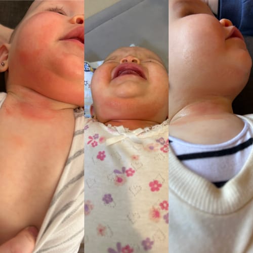Customer photo review of Organic Barrier Balm 90g