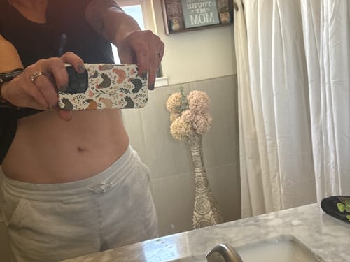 Customer photo review of SCULPT: Fat storage, cellulite, lymphatic stimulation with cotton wrap