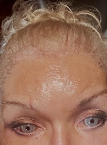 Customer photo review of Gimlet Pearl Yellow Colored Contact Lenses