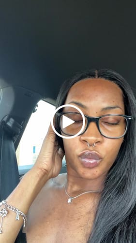 Customer video review of BIGGER EDITION: Jolie’s Full Body & Face Brightening / Acne Kit