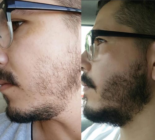 Customer photo review of Coffret Viking | Kit Professionnel Pousse Barbe