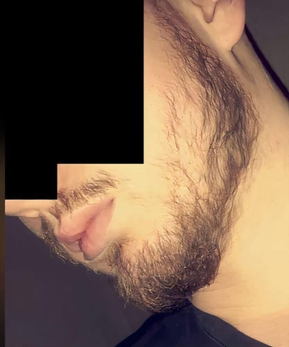 Customer photo review of Coffret Viking | Kit Professionnel Pousse Barbe