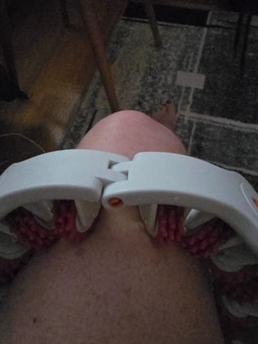 Customer photo review of Sculptroll™ | Cellulite-Roller