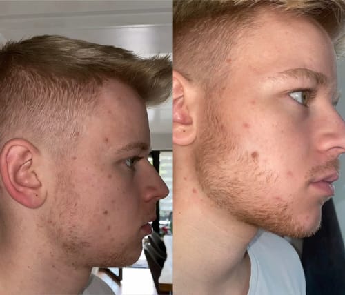 Customer photo review of Pack duo | L’Indispensable pour Stimuler la Barbe