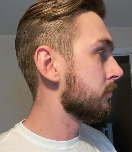 Customer photo review of Coffret Viking | Kit Professionnel Pousse Barbe