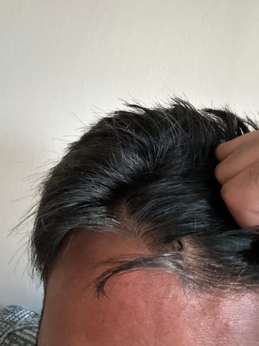 Customer photo review of Seb Natural Calming Serum