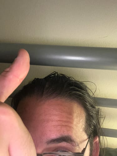 Customer photo review of Seb Natural Calming Serum