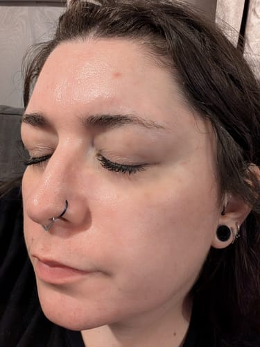 Customer photo review of Seb Natural Calming Serum
