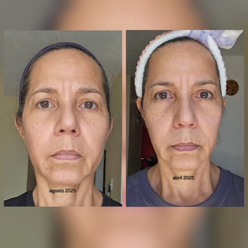 Customer photo review of Turmeric Face & Body Bundle of 3 soaps